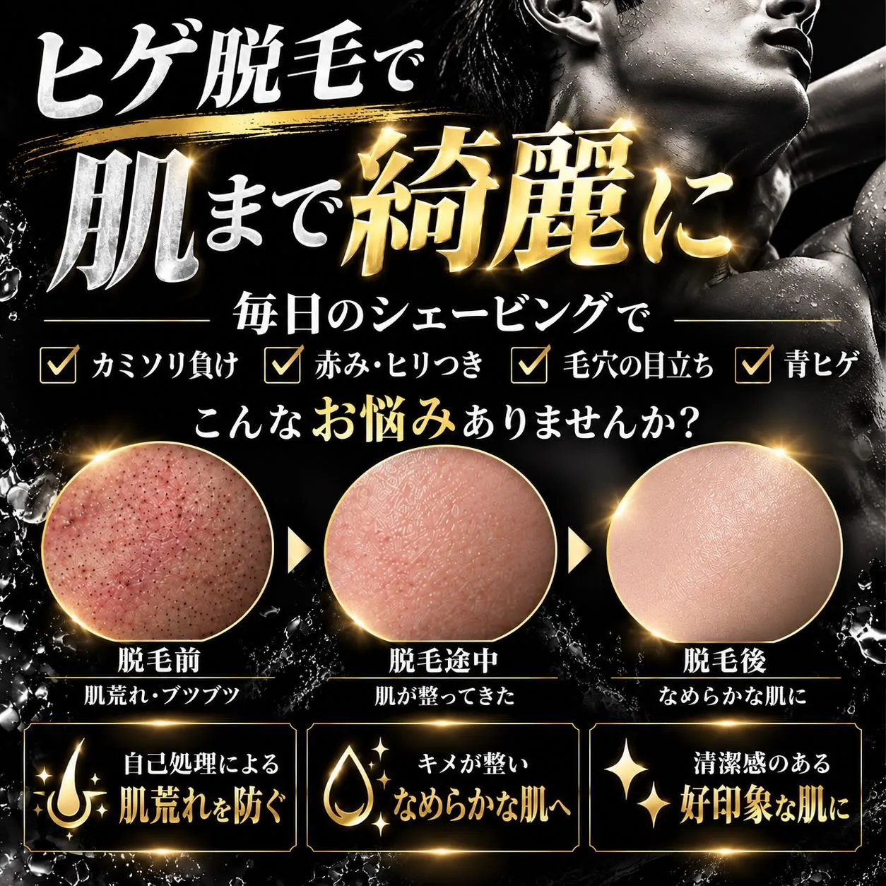 ヒゲ脱毛したら、肌まで綺麗になった。