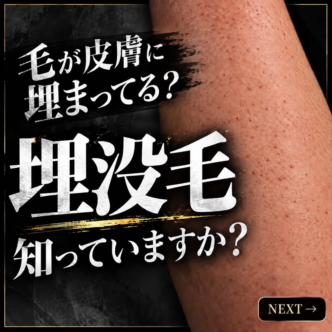 「短く小さな毛が残っている…」